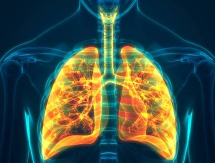 Acute vs Chronic Bronchitis